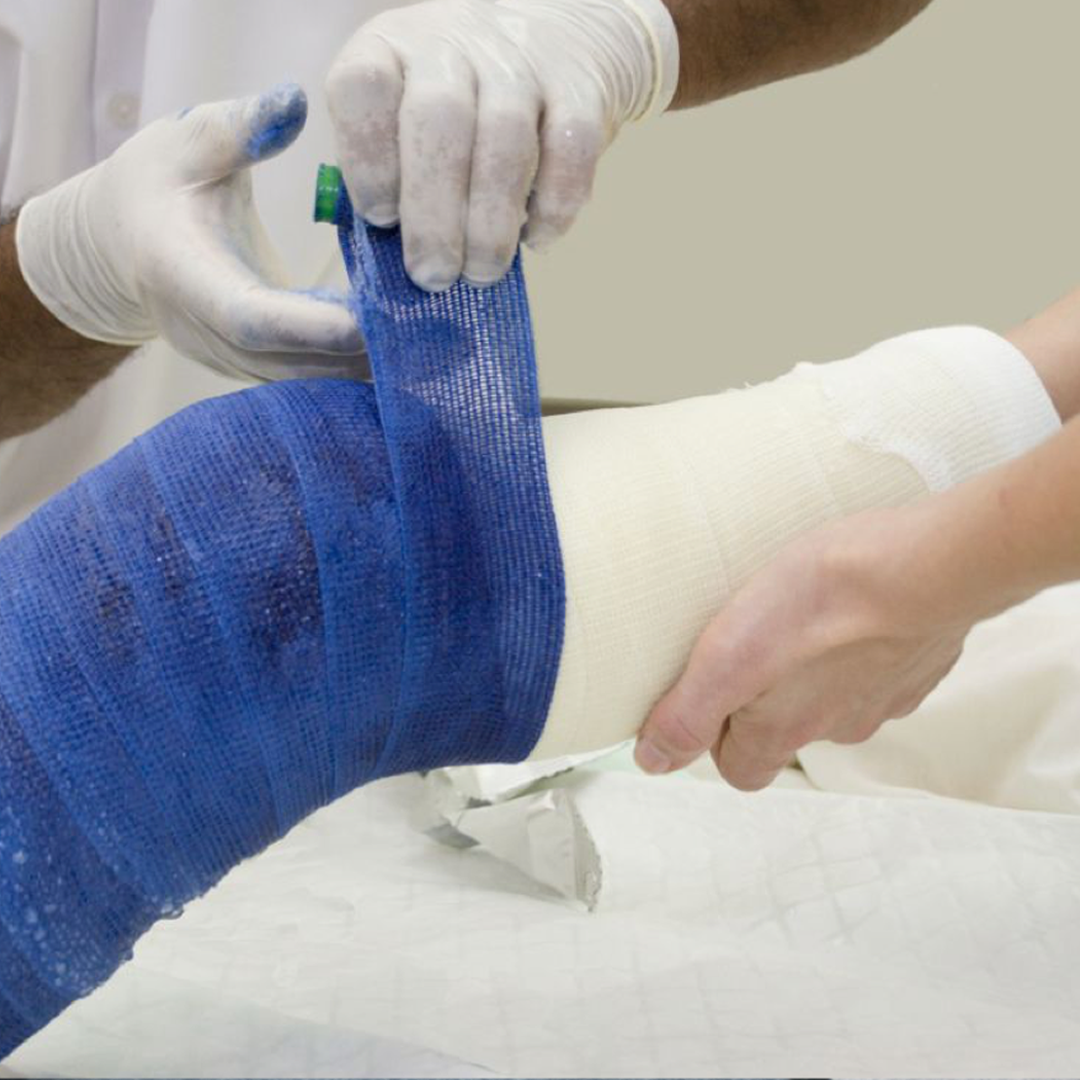 Casting & Splinting Materials available in online  pharmacy qatar, doha 