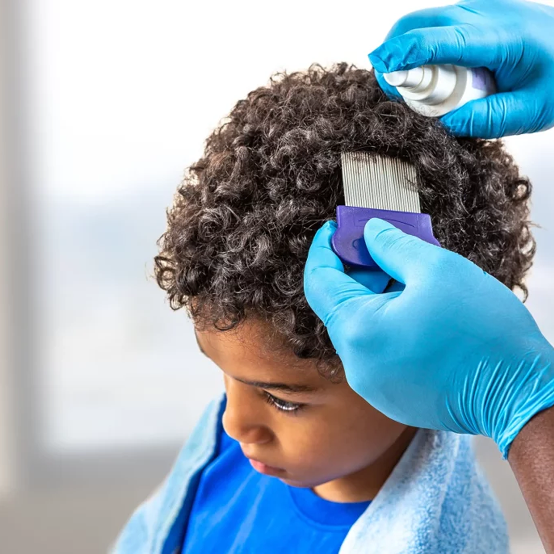 Lice Treatment available in online  pharmacy qatar, doha 