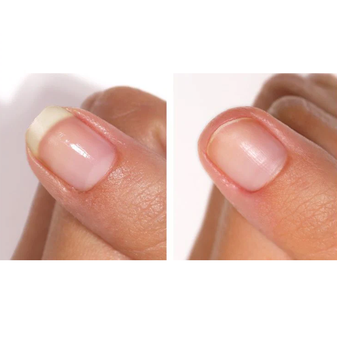 Nail hardeners available in online  pharmacy qatar, doha 