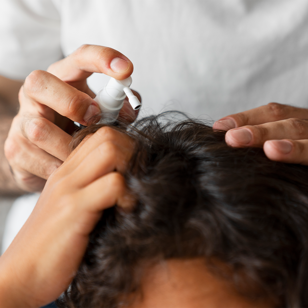 Scalp Medications available in online  pharmacy qatar, doha 