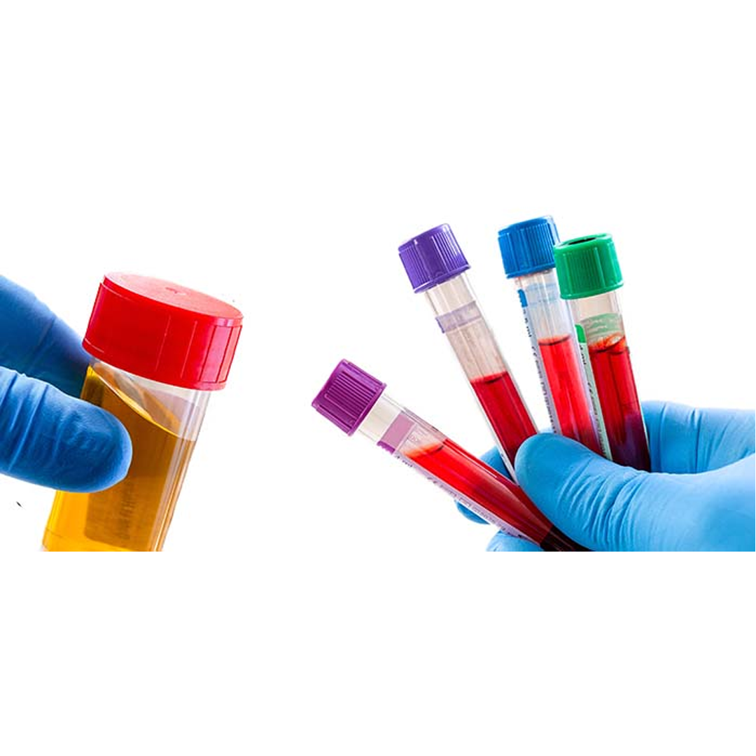 Specimen Collection available in online  pharmacy qatar, doha 