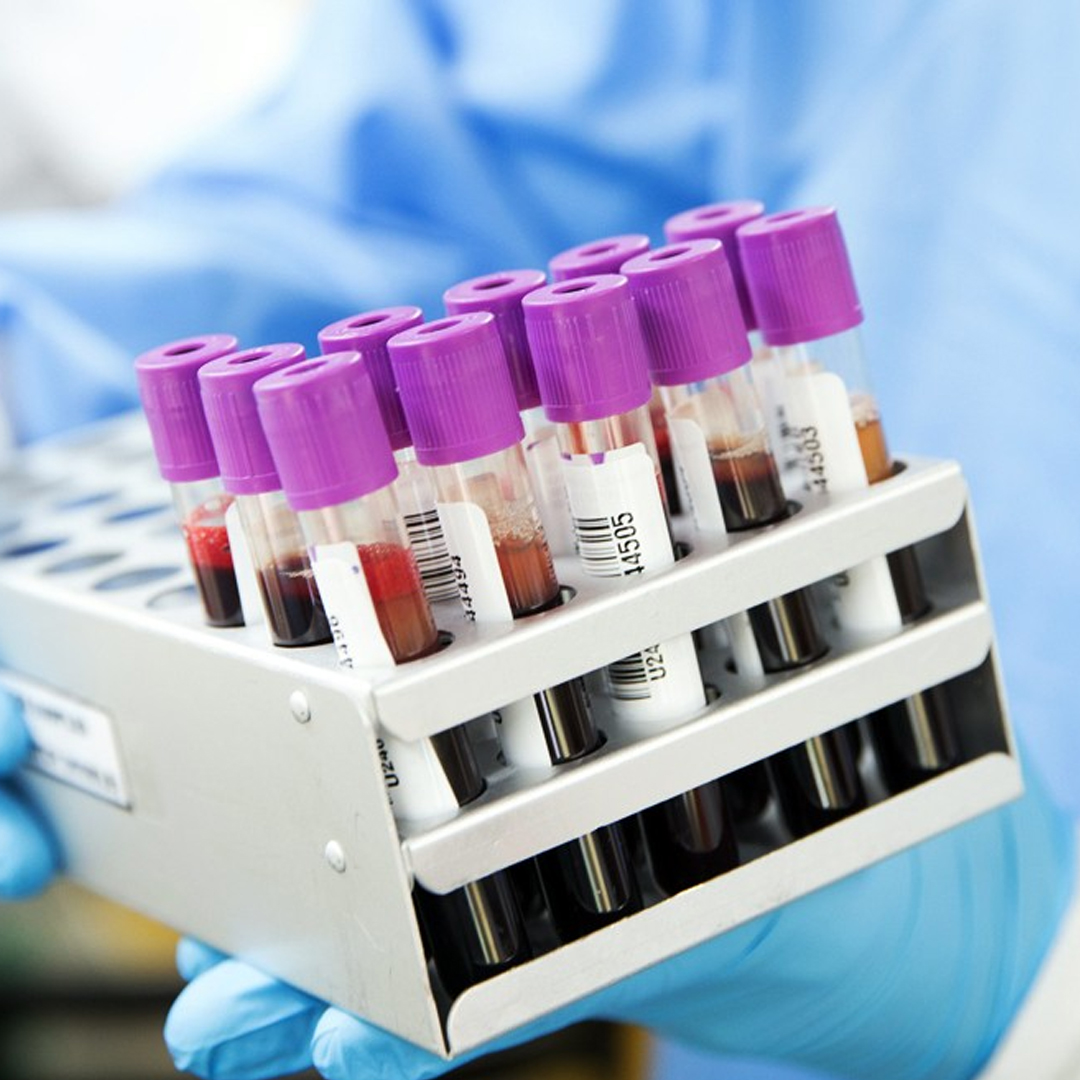 Tests available in online  pharmacy qatar, doha 