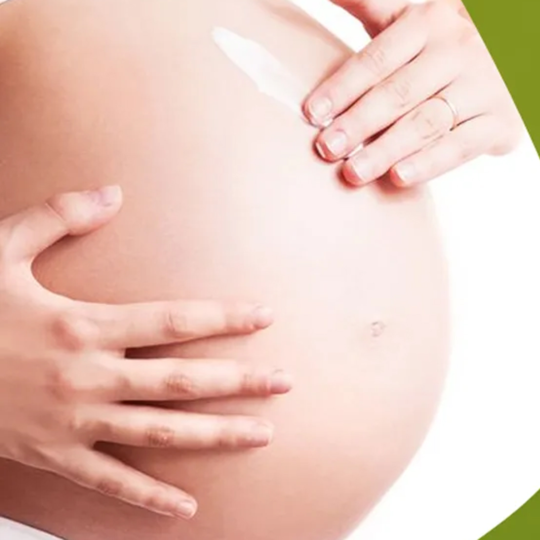 Stretchmark Lotion available in online  pharmacy qatar, doha 