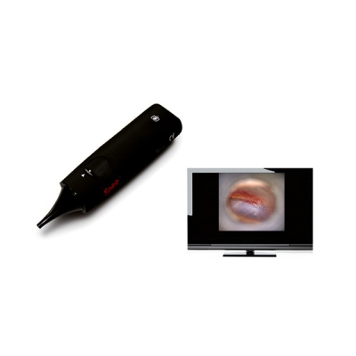 shop now Otoscope Wireless - Spirit  Available at Online  Pharmacy Qatar Doha